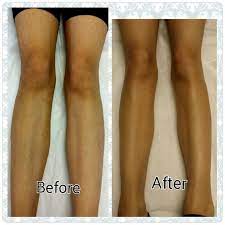 Before After Full Leg Wax Call Or Text Skin Care Diva For Your Appointment 661 8086111 65 Waxing Legs Natural Skin Care Good Skin