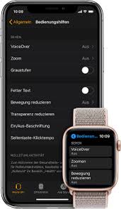 Abbott had not been expecting the huge run on the i can also share readings and see readings on my apple watch even without the iphone. Bedienungshilfen Auf Der Apple Watch Verwenden Apple Support