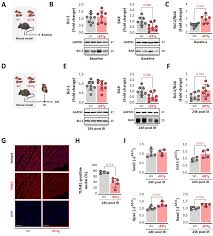 β3-Adrenergic receptor overexpression in cardiomyocytes preconditions  mitochondria to withstand ischemia–reperfusion injury | Basic Research in  Cardiology