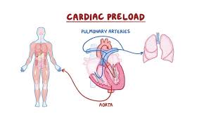 Image result for Preload