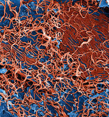 In recent years, vero cells have been under consideration for use in the development of new kinds of treatments for various diseases, such as diabetes. Ebola Virus Particles Budding From Chronically Infected Vero Cells Science Collection Scanning Electron Microscope Stock Photo 166084410