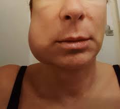 Holly L. Barbour, MD, Physician