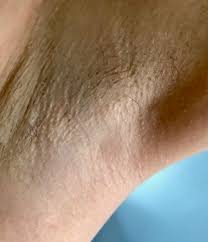 But what's relevant to us is that a laser is a monochromatic ipl for hair removal is of a several wavelengths absorbed by melanin. Does Ipl At Home Work Philips Lumea Review Indiana Jo