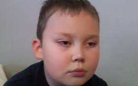 Zrzutka na Operacja Oka dla KRZYSIA