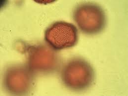 Image result for Erythrococca