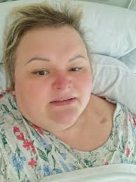 Лекарство От Рака Беларусь 2025