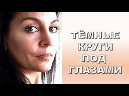 как убрать тёмные круги под глазами в домашних условиях Kak Ya Izbavlyayus Ot Tyomnyh Krugov Pod Glazami Youtube Temnye Krugi Pod Glazami Krugi Pod Glazami Pod Glazami