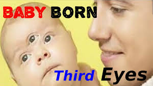 Three Eyes Baby Viral Video 2020 Baby Born With 3 Eyes Baby Born Third Eyes The Sachin Youtube