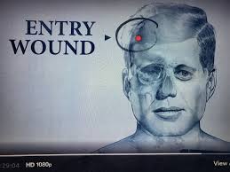 THE JFK ASSASSINATION PART 2. WHAT THE DOCTORS ORIGINALLY SAW