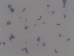 Sometimes the cocci occur in clusters eg. Micromorphology Slides Microbiology Resource Center Truckee Meadows Community College