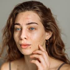 Aubrey Winn's Instagram, Twitter & Facebook