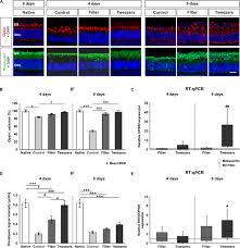 Maybe you would like to learn more about one of these? Frontiers Novel Porcine Retina Cultivation Techniques Provide Improved Photoreceptor Preservation Neuroscience