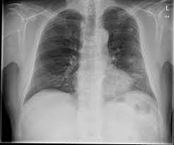 Radiographic Contrast Radiology Reference Article Radiopaedia Org