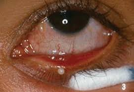 Image result for Blepharis bainesii