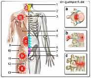 Detailed translations for anordnung from german to english. Abbildung Ruckenschmerzen Mittlerer Rucken