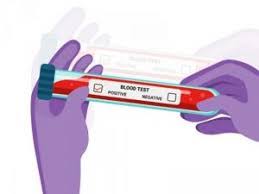 Mana Yang Lebih Akurat Rapid Test Atau Swab Test Portonews