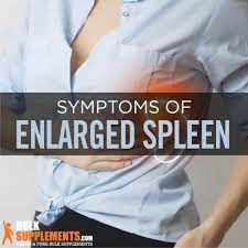 Enlarged Spleen: Symptoms, Causes & Treatment |