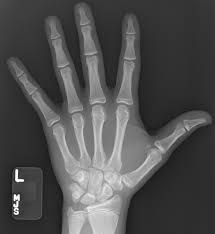 Image result for Growth Plate