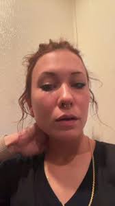 What to Do If Your Dog Gets Bit by A Brown Recluse Spider in The inside of  Her Paw