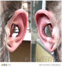 We have an excellent selection of rx7 custom parts, like body kits, carbon hoods, custom seats, and rims, to name a few. What Is A Conch Removal Procedure And Why Did This Man Do It To His Ears Allure