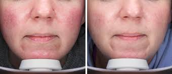 Donna Donaghy Skincare & Laser Ltd