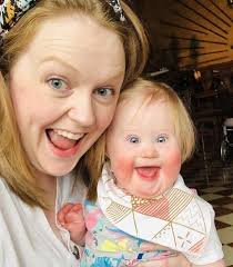 Rare Triplets With Two Conjoined Given Up for Adoption 19-years Ago, See  Them Today...See more: https://tr.ee/OhW You won't regret liking the  picture 😢😘😍❤️ . . . . . . . . Ten