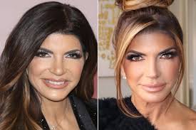 Stars Who Love Their Plastic Surgery (Photos)