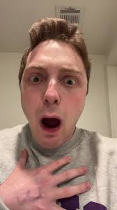 #stitch with @nickjonas WHAT DID I JUST WAKE UP TO