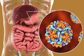 Hepatitis is often caused by a virus. Colorectal Liver Metastasis Linked To Chronic Hepatitis B Infection Status Oncology Nurse Advisor