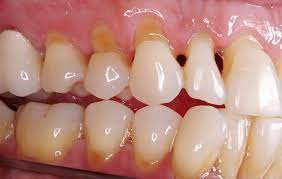 Pin On Pearly Whites