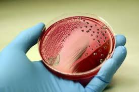 Resistance to antibiotics used to treat salmonellosis in humans and animals, including. Texas A M Research Unlocks Mystery Of Salmonella Infection Texas A M Today