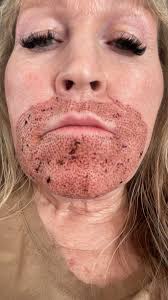 I use the collagen burn and I'm thinking of adding the detox…can I get  everyone's opinions?!