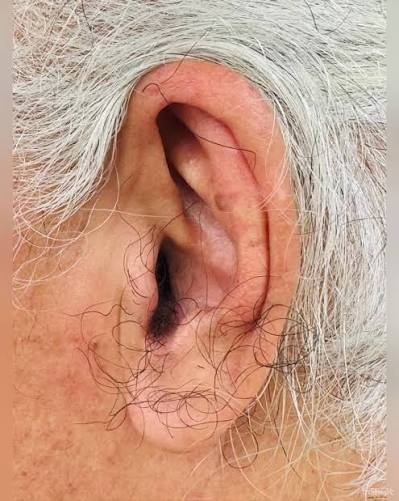 KỲ NHÂN HIẾM CÓ TRÊN THẾ GIỚI LÔNG MỌC TỪ TRONG TAI RA DÀI NHƯ TÓC -  HUYNHCHAU | Ngọc Châu | Facebook
