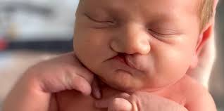 Danielle Orton is fundraising for Cleft Lip And Palate Association