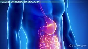 Those without however, this definition of normal range of serum uric acid in the general population is inevitably influenced by what we consider as normal, since the absence of. What Is Uric Acid Levels Causes Symptoms Video Lesson Transcript Study Com