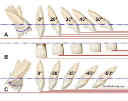 Le Deplacement Des Dents En Orthodontie Bucco