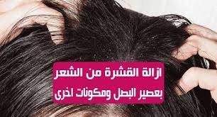 طريقة ازالة القشرة من الشعر قشرة الشعر من اكثر المشاكل المزعجة لدى العديد من الاشخاص سواءا رجالا كانو او نساءا لكن عصير البصل هو الحل الامثل والسهل للتخلص من ا