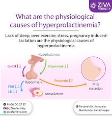 Image result for Hyperprolactinemia