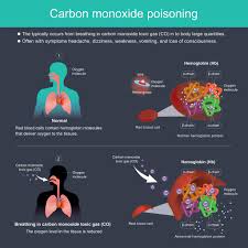 Image result for Styrene Poisoning