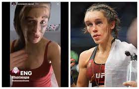 I can't wait for this #fight at #ufc223! Joanna Jedrzejczyk Pokazala Twarz Tydzien Po Walce Z Zhang Weili Opuchlizna Zeszla Z Czola Ale Sportowy24
