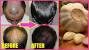 Garlic For Hair Growth Reviews