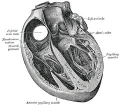 Image result for Left Ventricular Outflow Obstruction