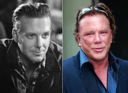 Mickey Rourke Photos Celebs Who Had Plastic Surgery Or Didn T Celebrity Plastic Surgery Bad Celebrity Plastic Surgery Mickey Rourke Plastic Surgery