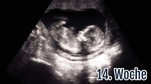 14 Ssw Die 14 Schwangerschaftswoche Bauch Gewichtszunahme Netmoms De