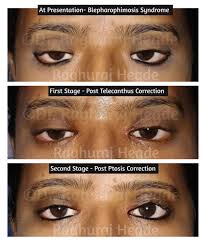 Image result for Blepharis involucrata