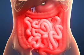 Image result for Midgut Volvulus