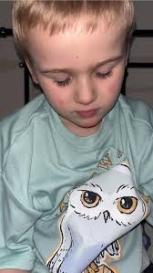 Infected BBL Azz Cheeks 🤦🏿‍♂️