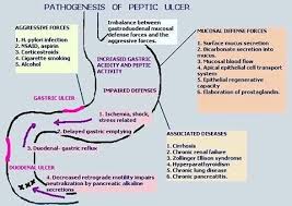 Medical Examinations Peptic Ulcer Ulcers Gastrointestinal Nursing