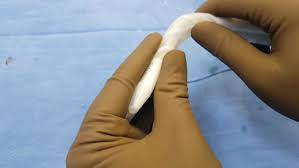 The main reason as to why this happens is that following the penile implant, the glans or … Best Penile Implant Surgery In India By Dr Raman Tanwar