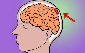 We did not find results for: Kenali 5 Tanda Ketumbuhan Otak Yang Paling Kerap Berlaku Benign Meningioma Iluminasi
